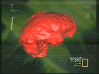 Hobbit Brain CT Scan