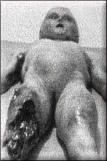 Roswell Alien Autopsy