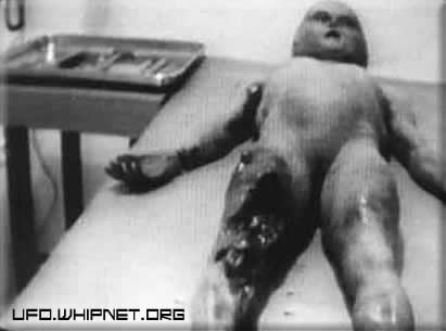 Roswell Alien Autopsy 1