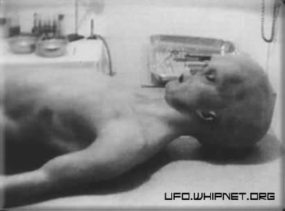 Roswell Alien Autopsy 2